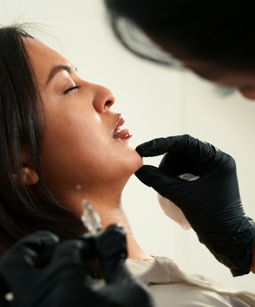 Dermal Fillers in Houston TX